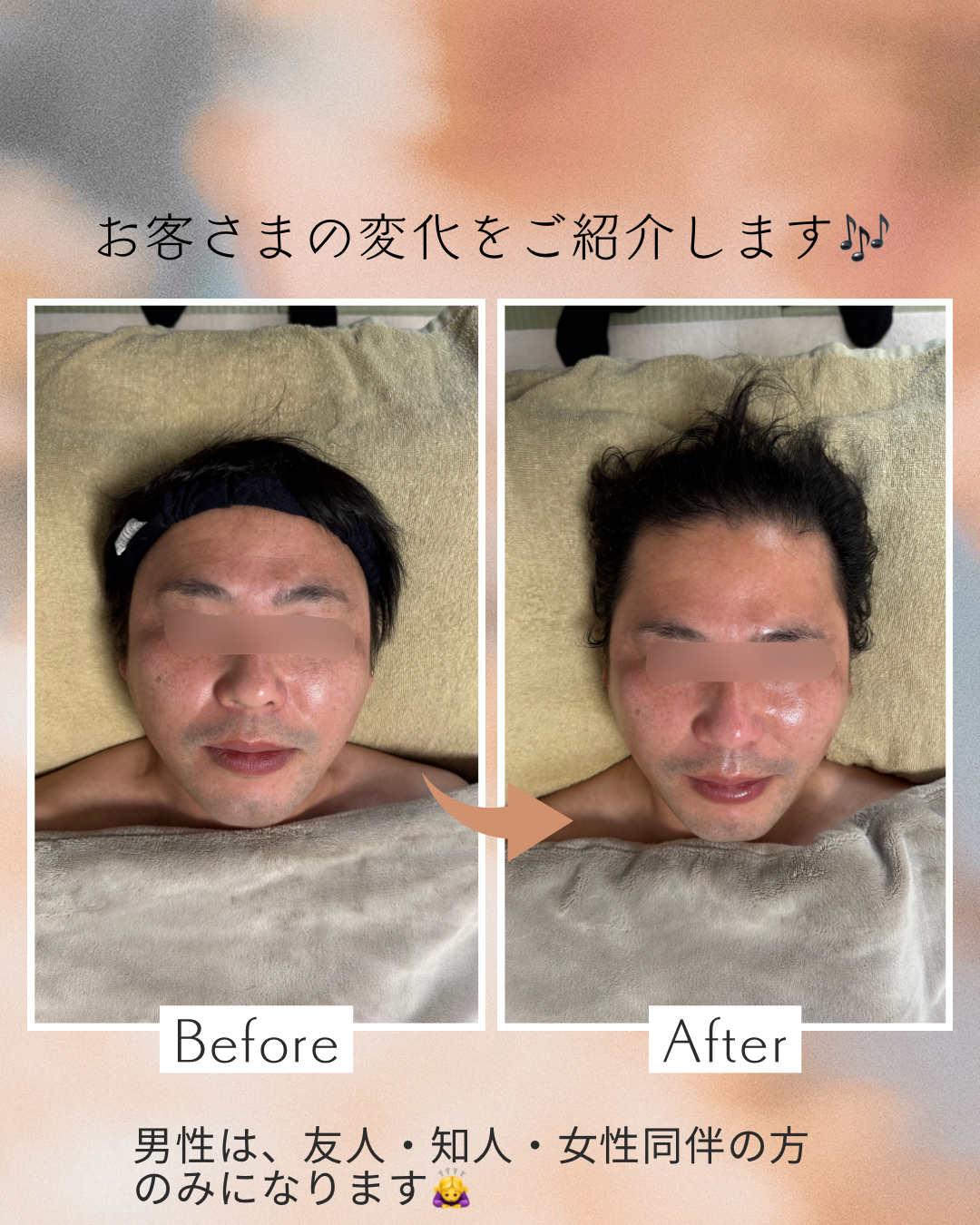 ビフォーアフター